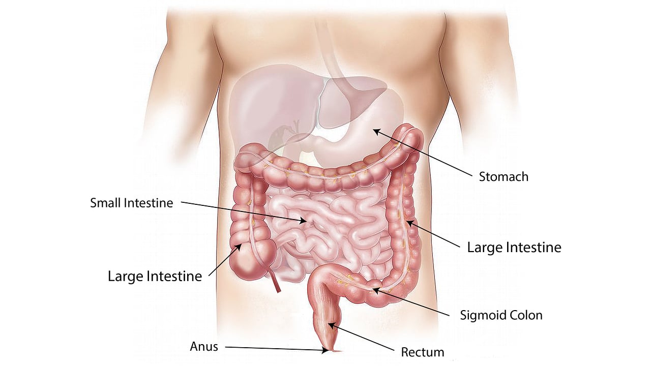 Morbo di Crohn