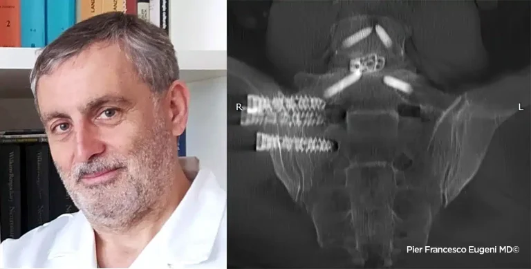 intervento-eugeni-hd